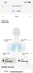 BeamO revolutionary 4-in-1 MultiScan device for personal, family and teleconsultation use.A complete health tool for your heart and lungs.